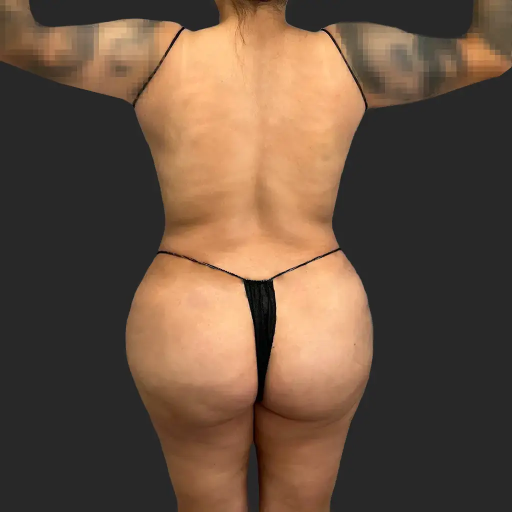 After image