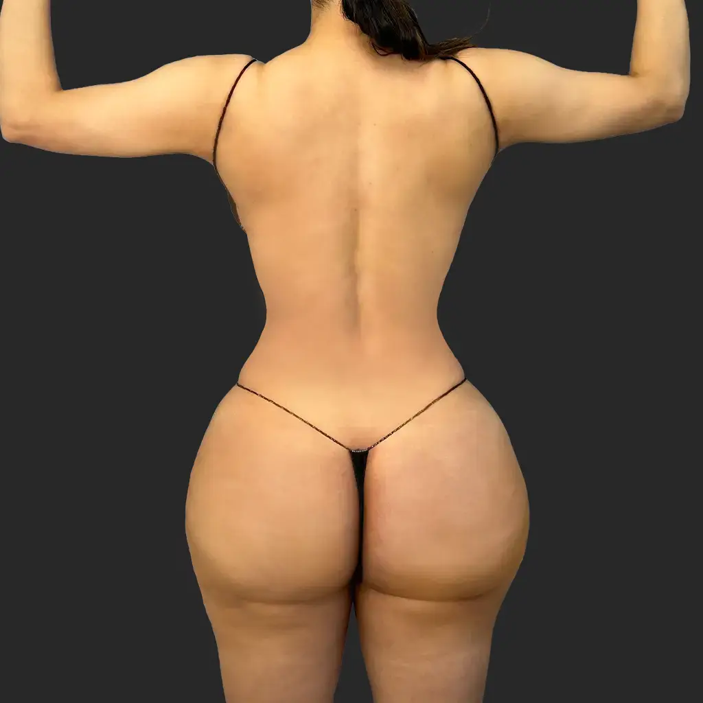 After image