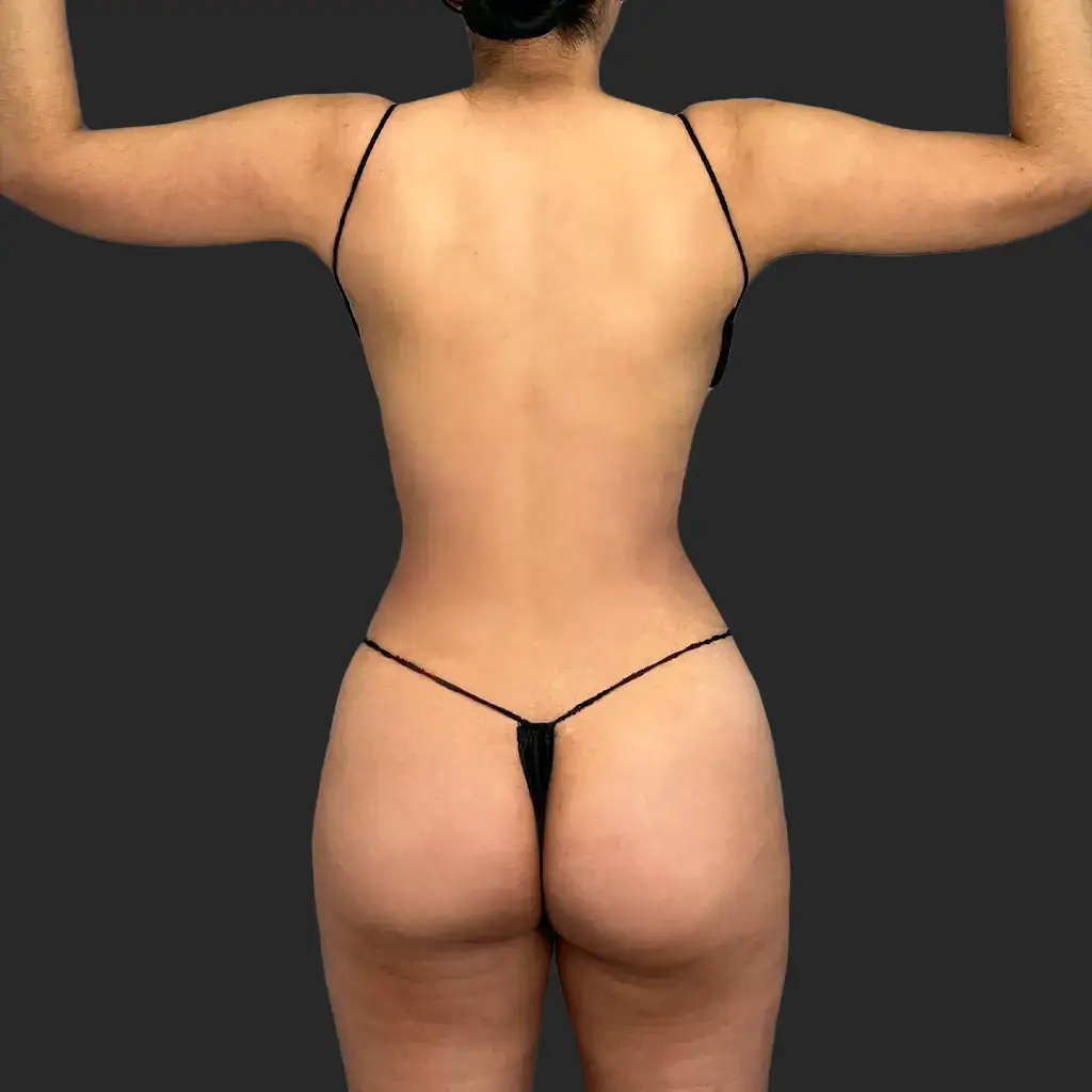 After image