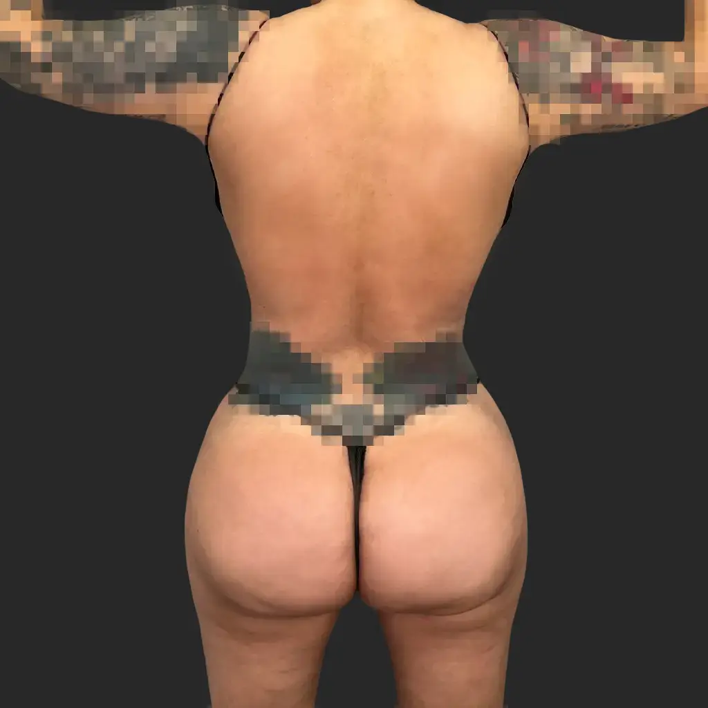 After image