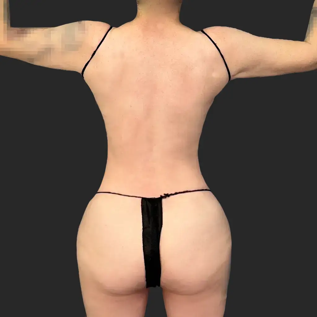 After image