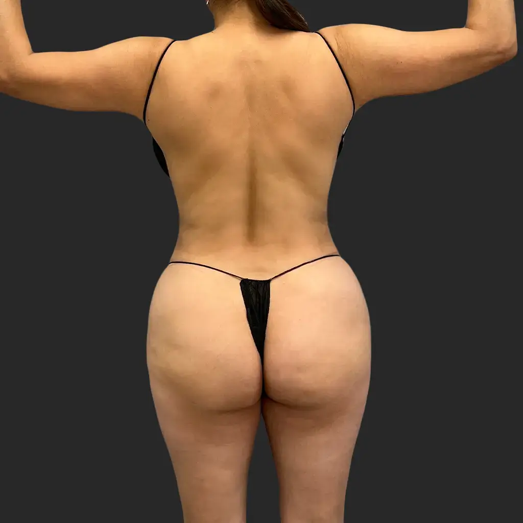After image