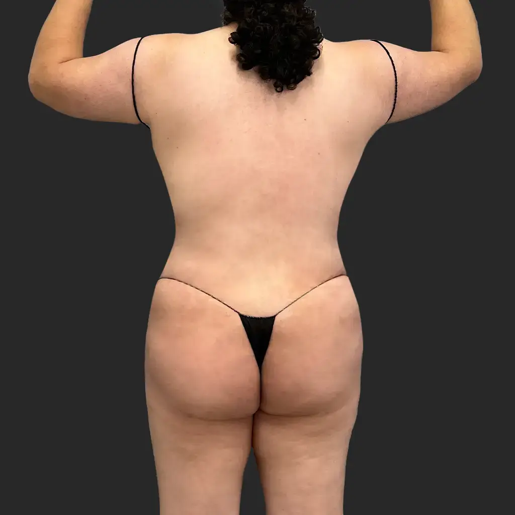 After image
