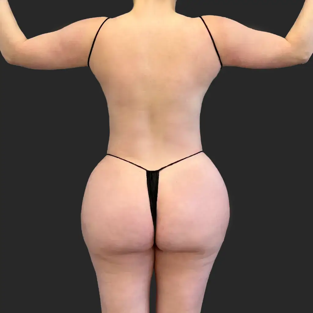 After image