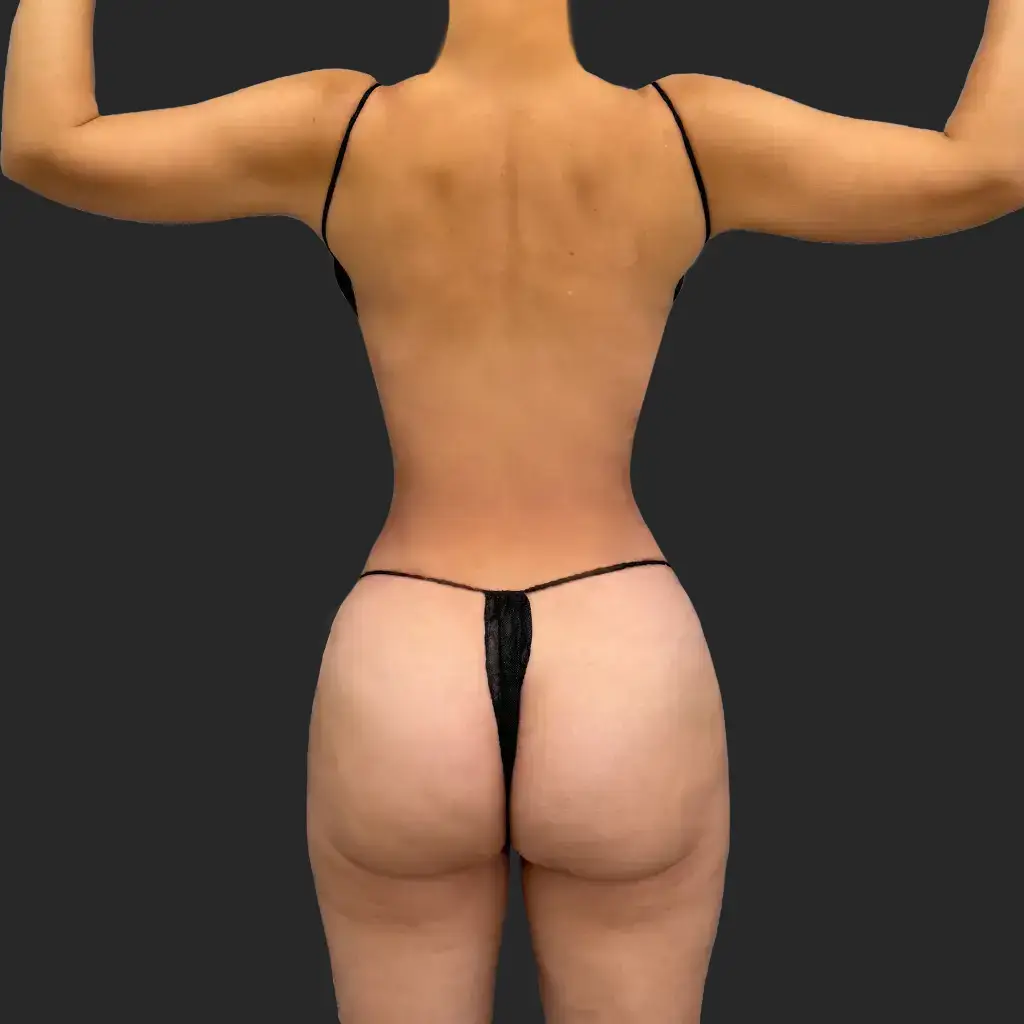 After image
