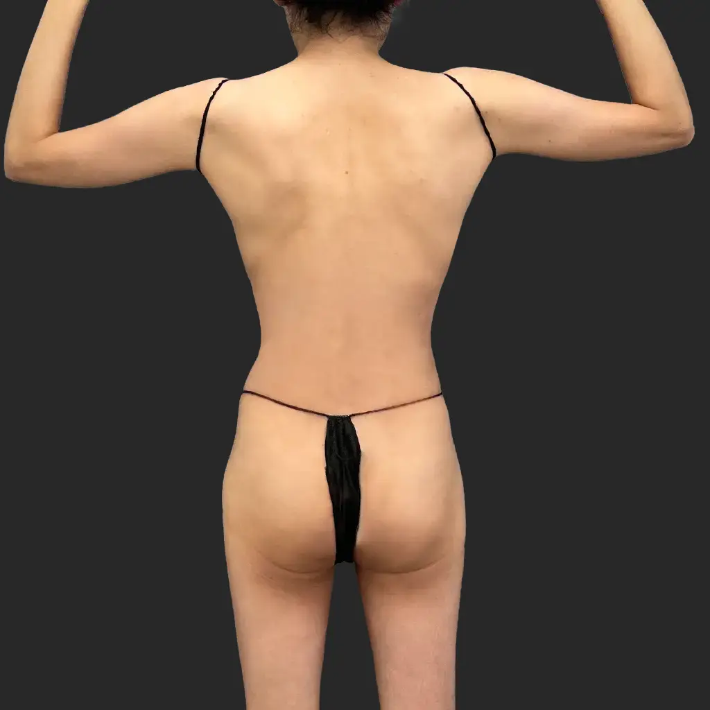 After image