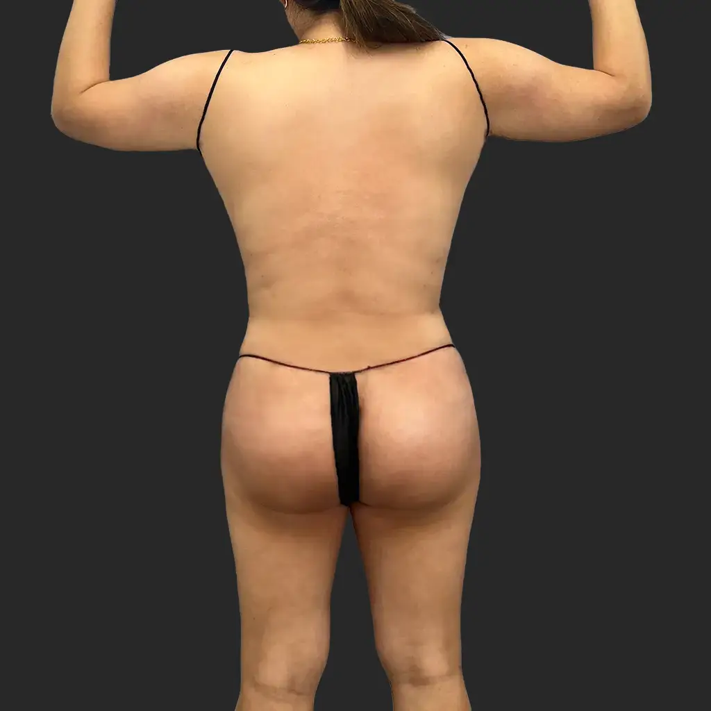 After image
