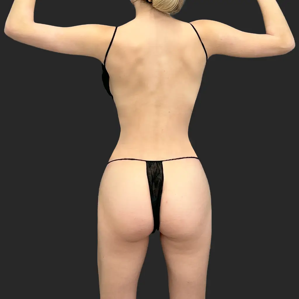 After image
