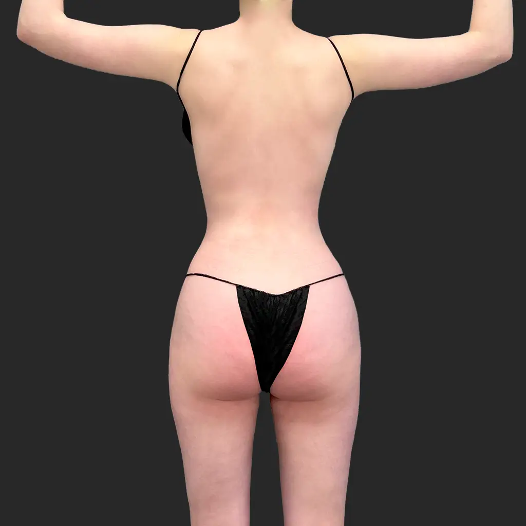 After image