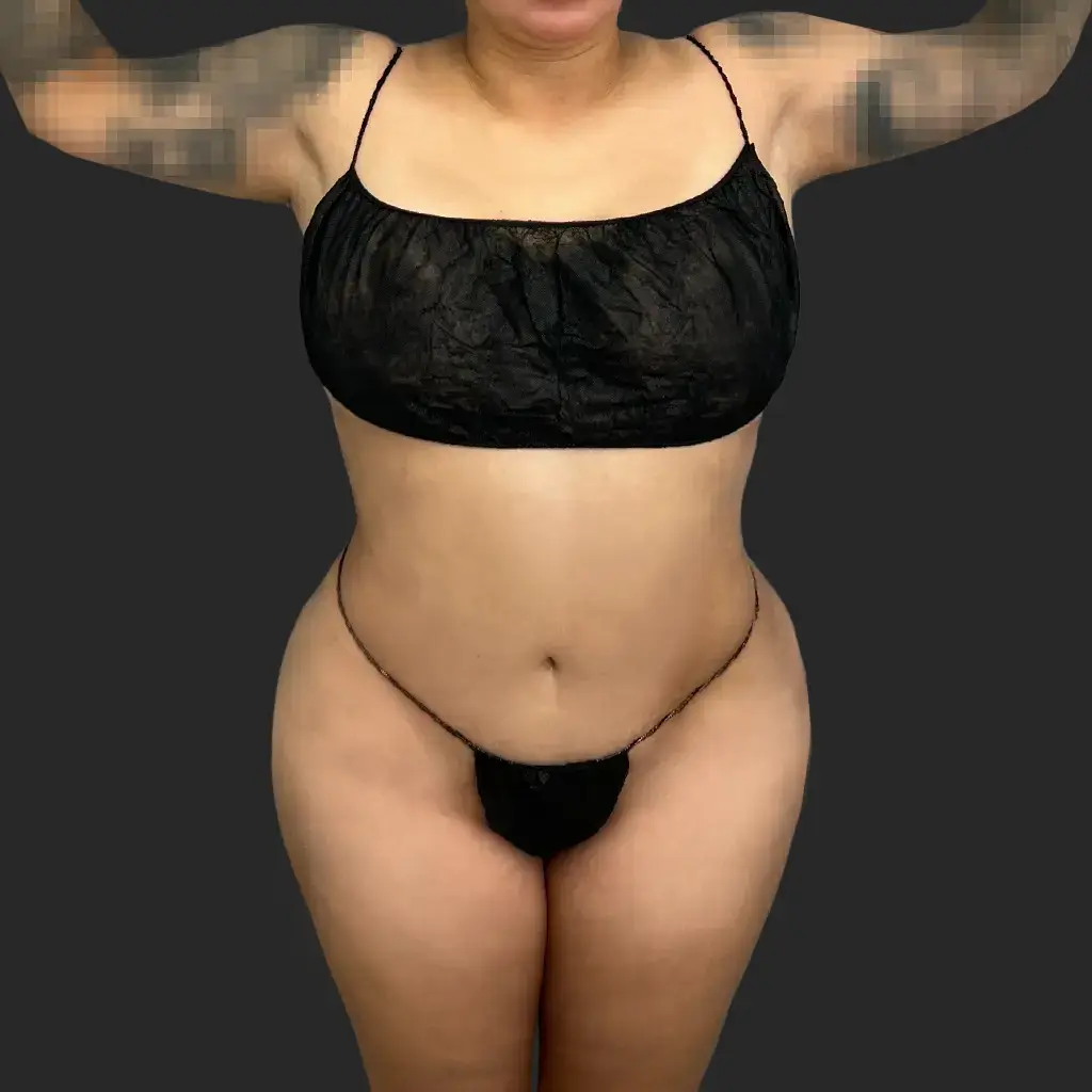 Additional after image