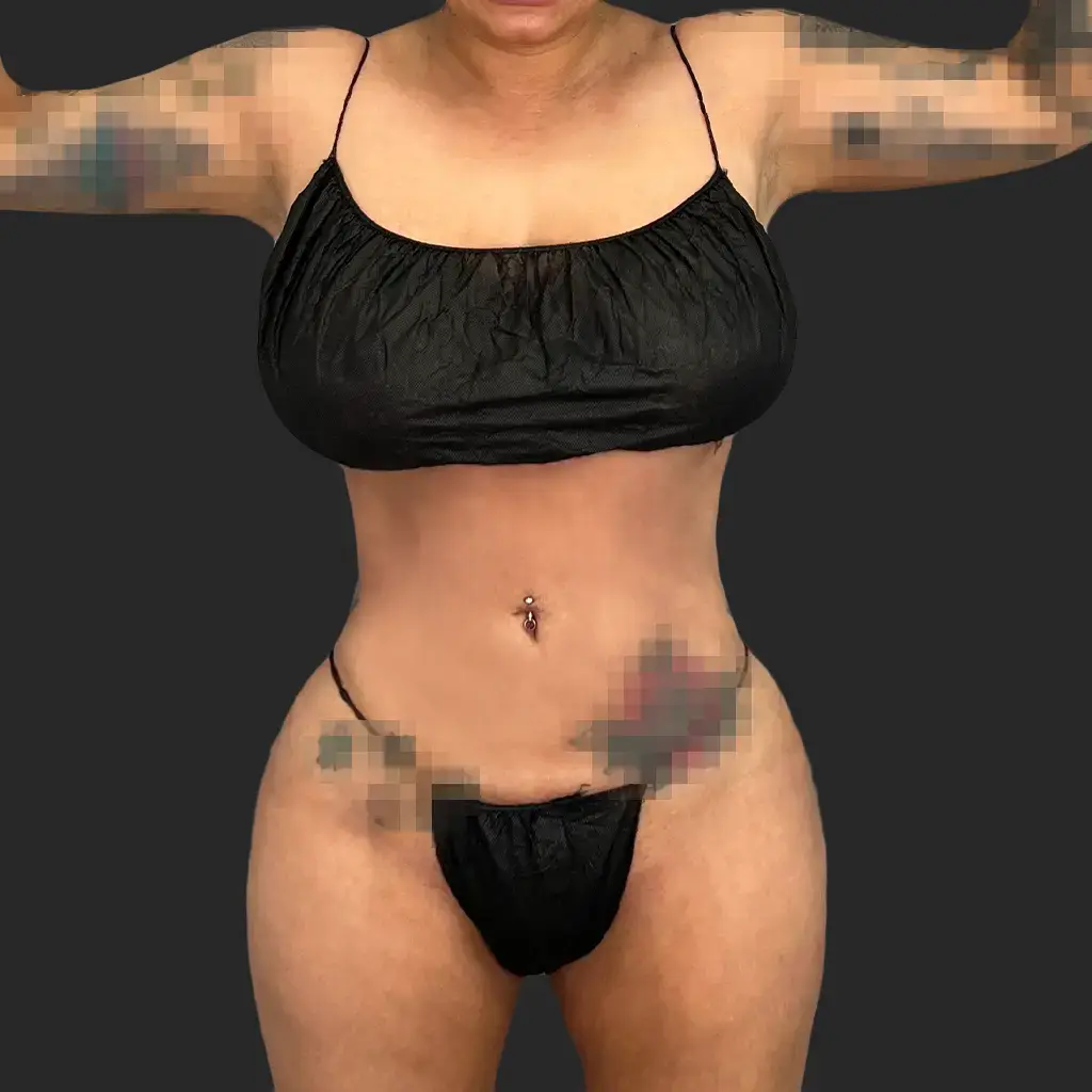 Additional after image