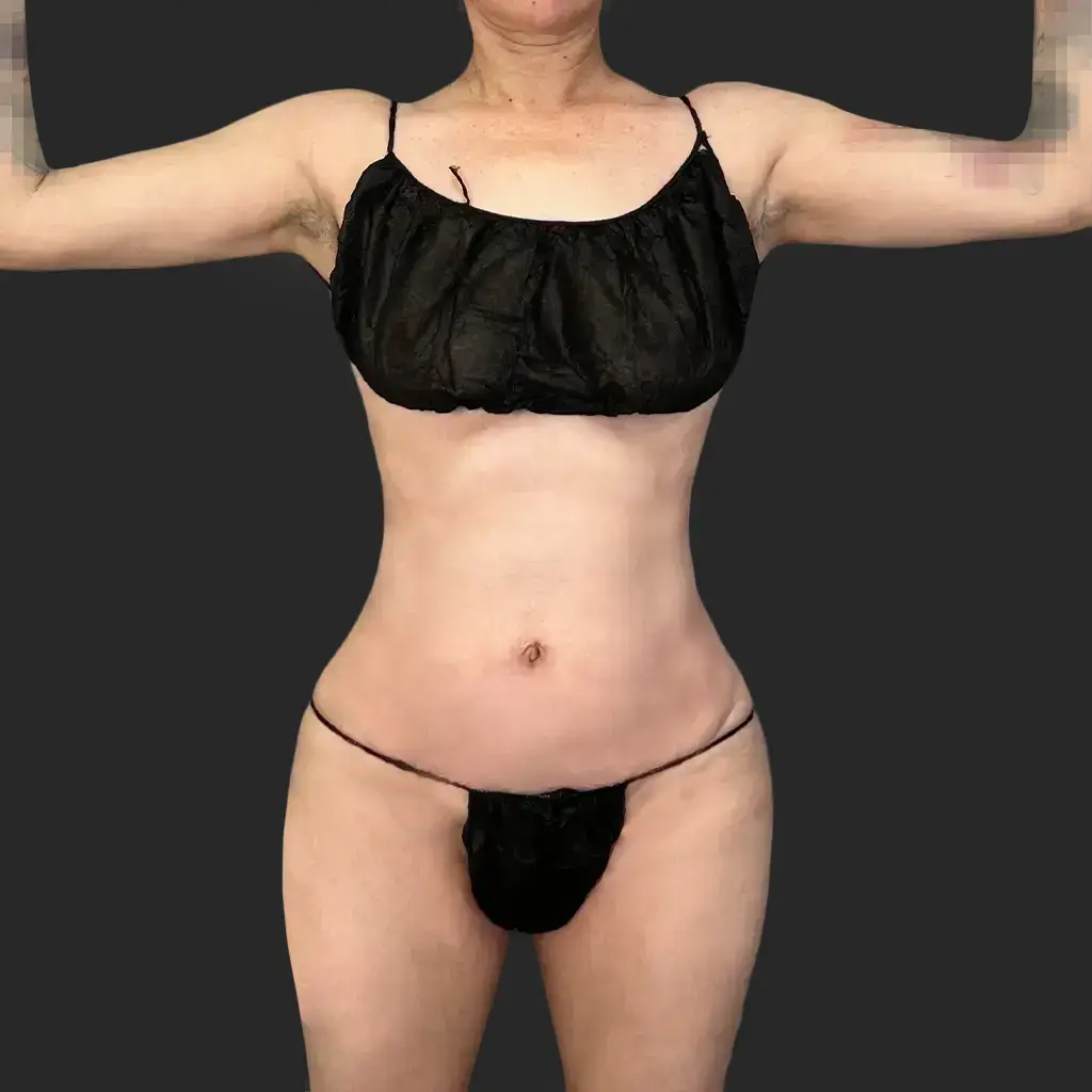 Additional after image