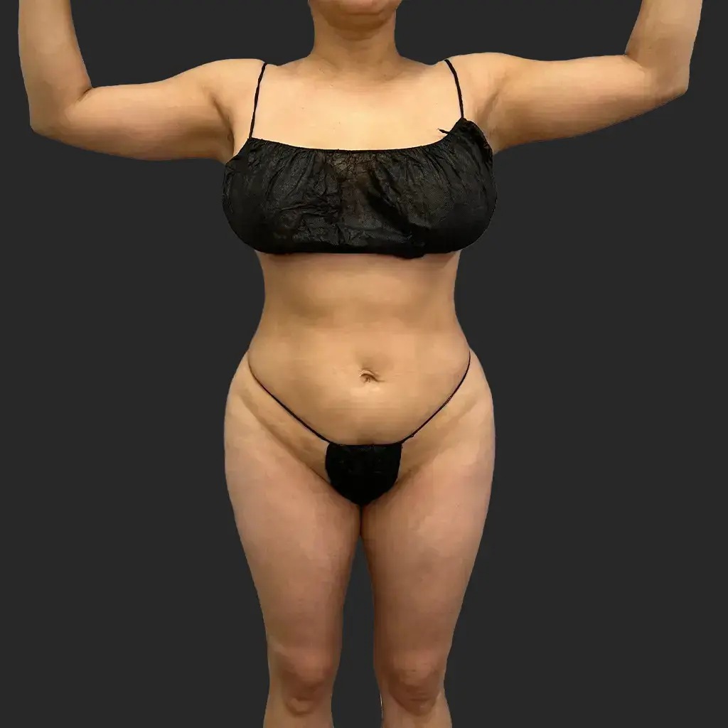 Additional after image