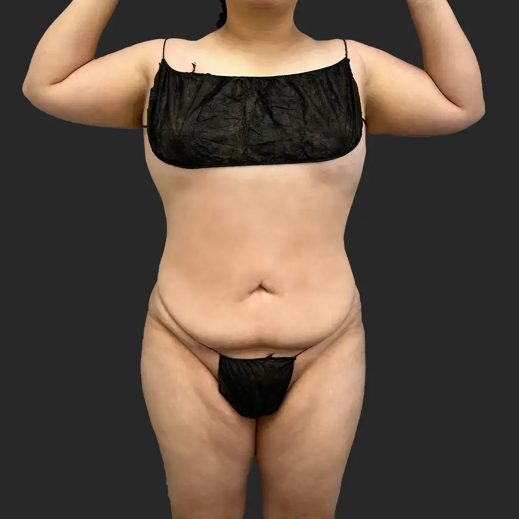 Additional after image