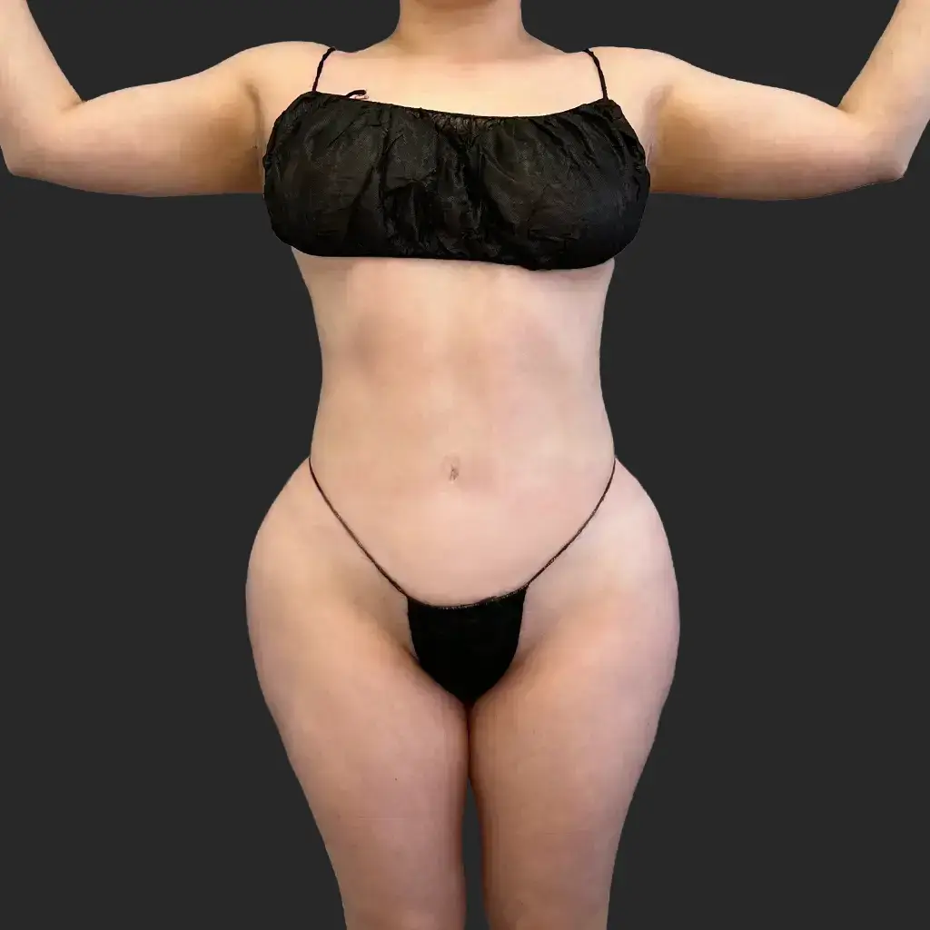 Additional after image