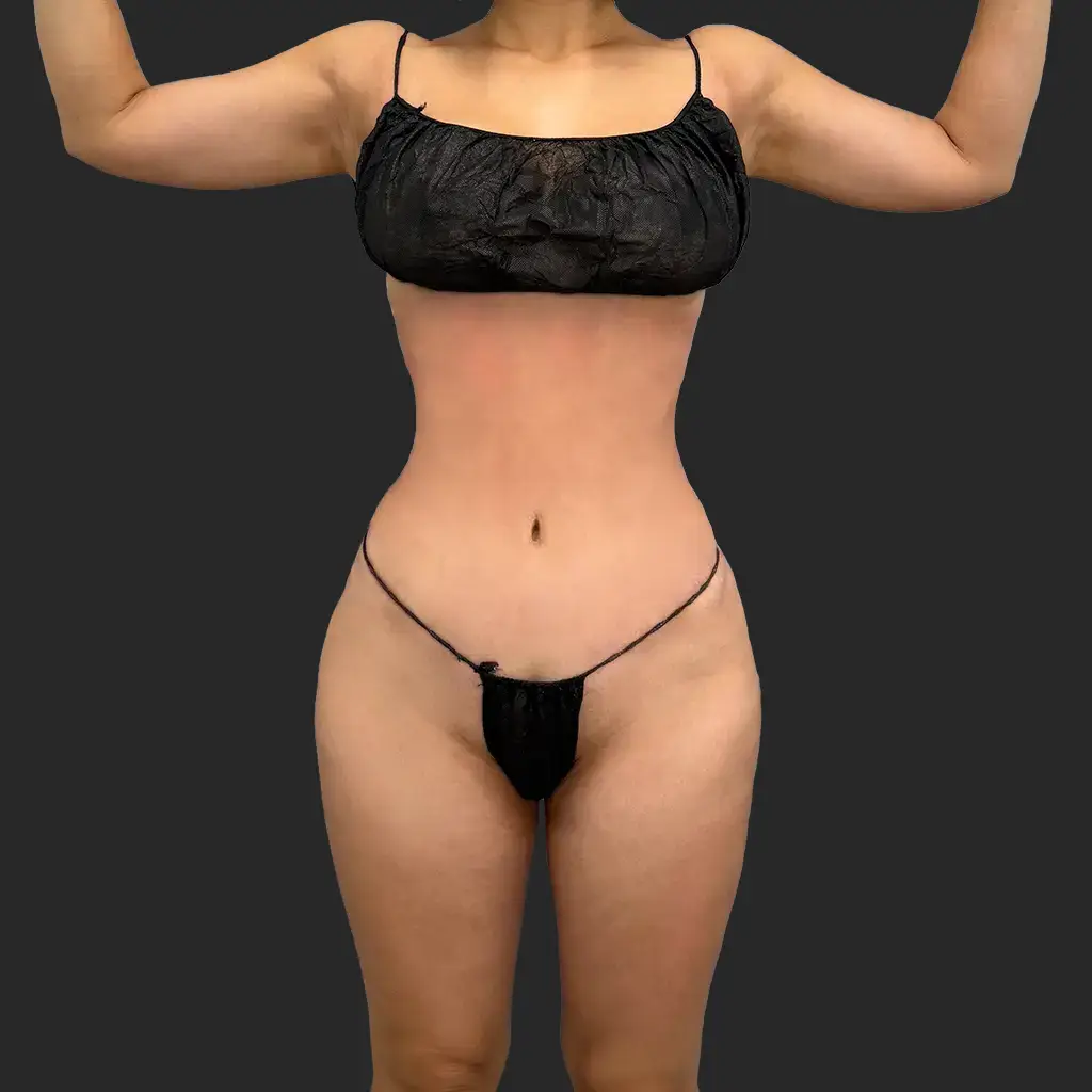Additional after image