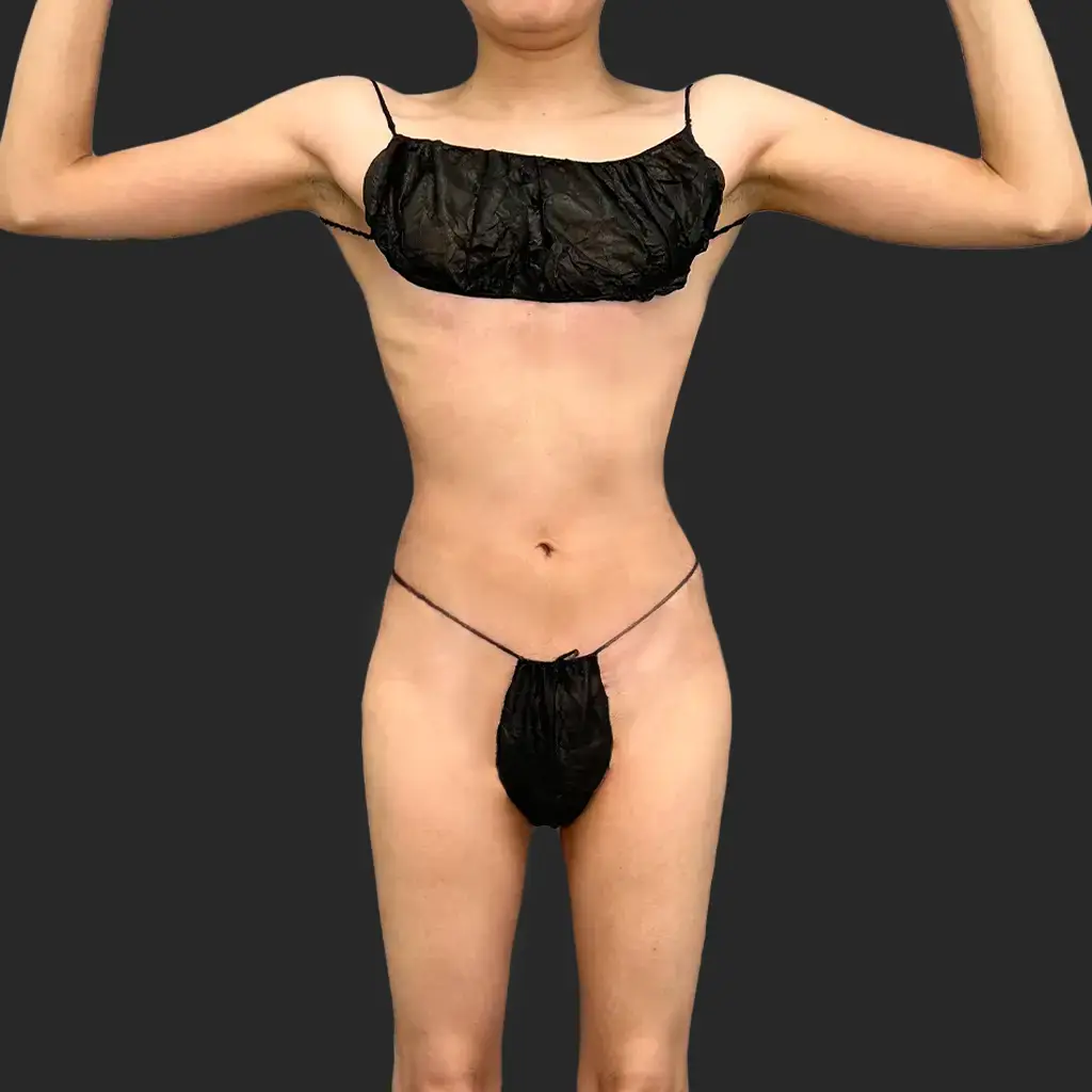 Additional after image