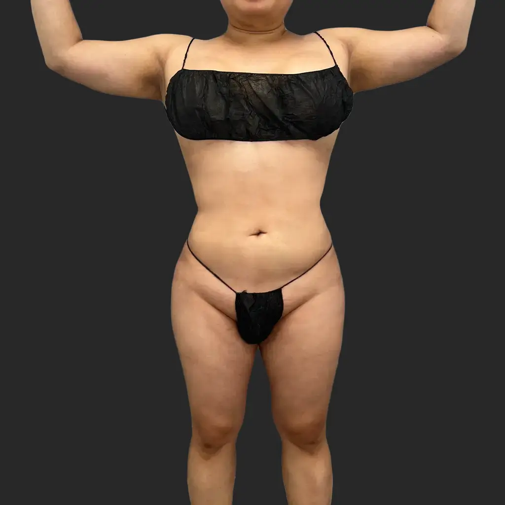 Additional after image