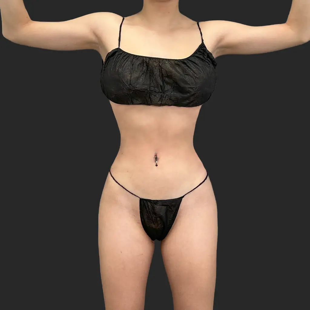 Additional after image