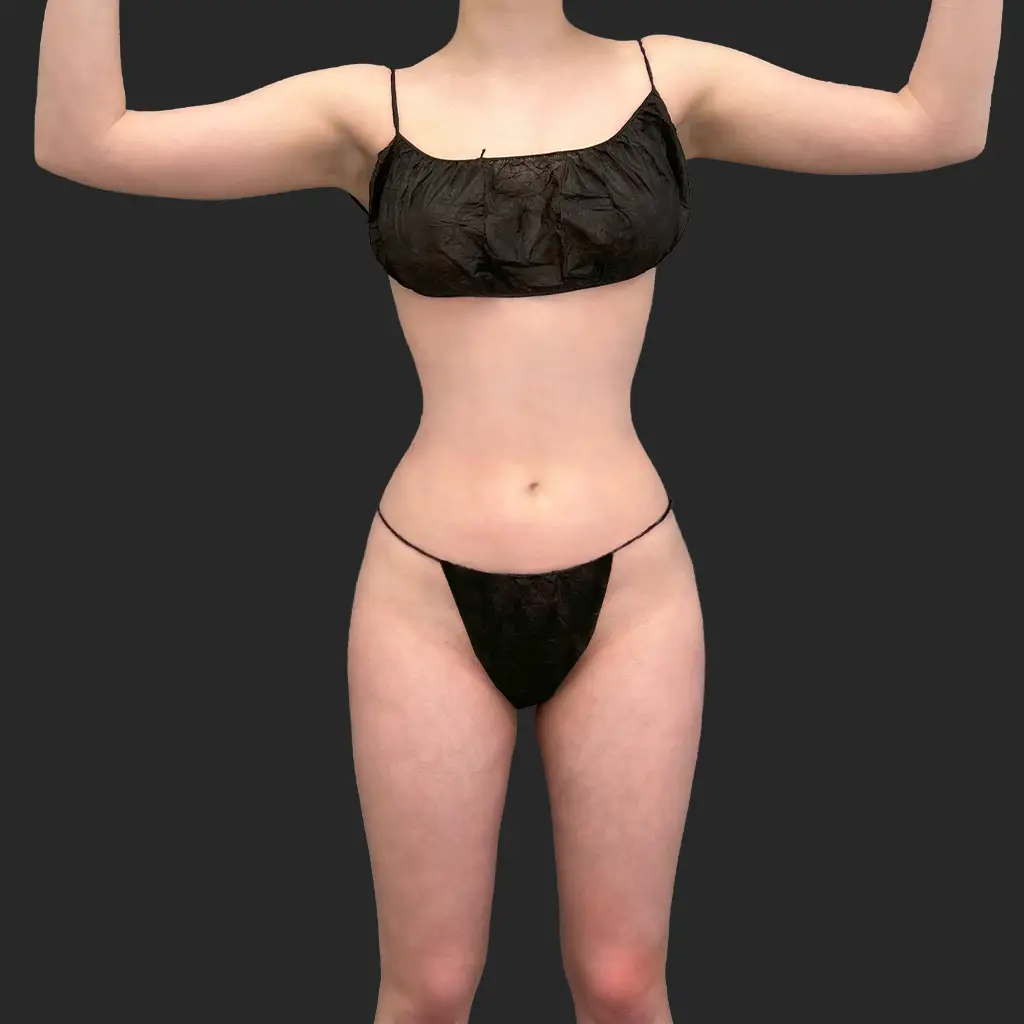 Additional after image