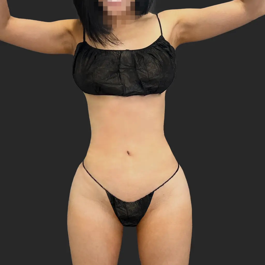After image