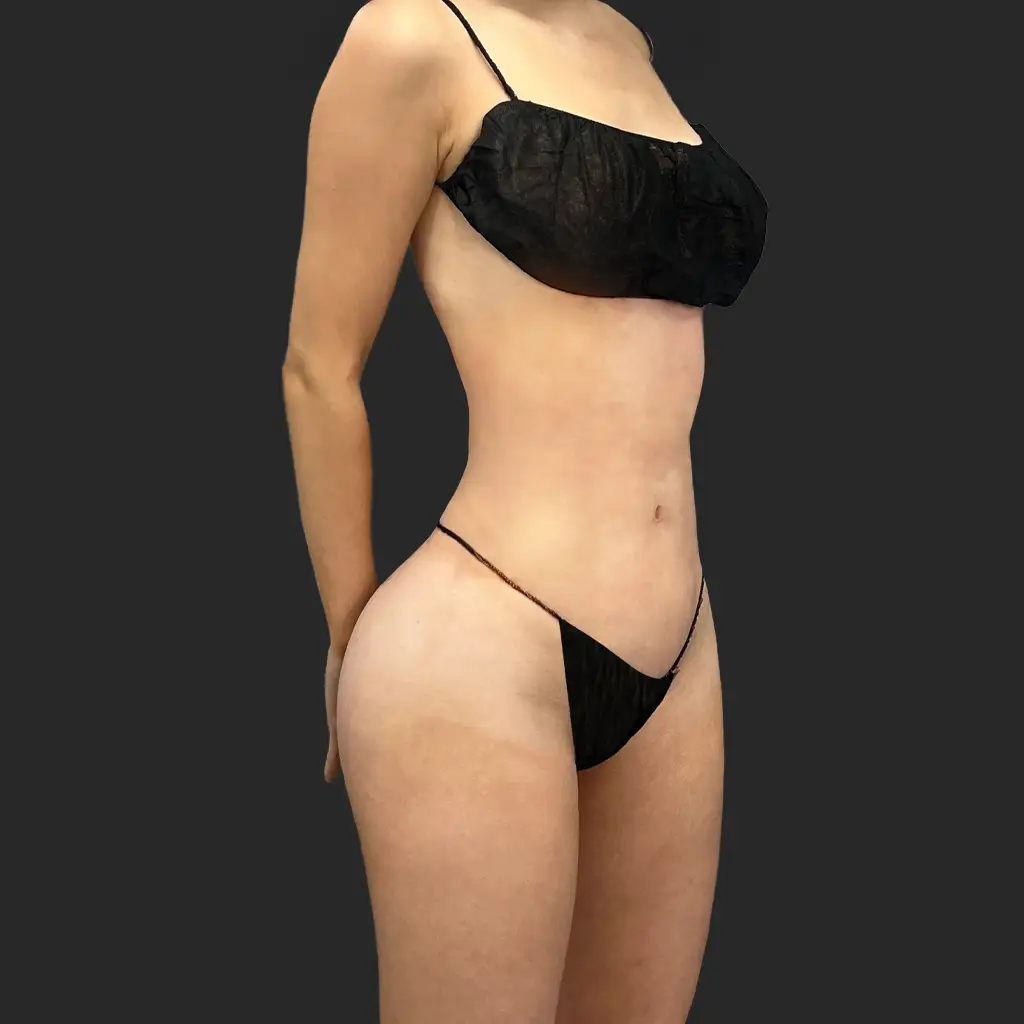 Additional after image