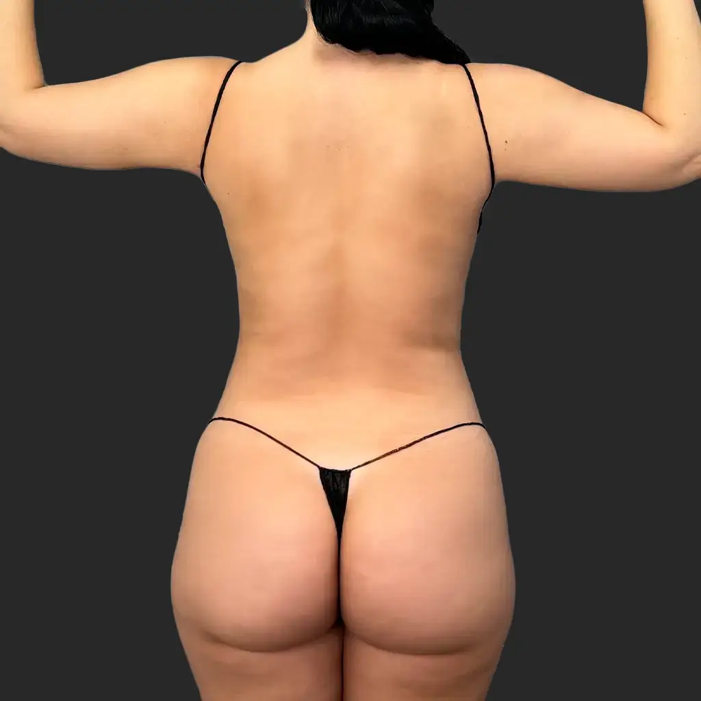Before image