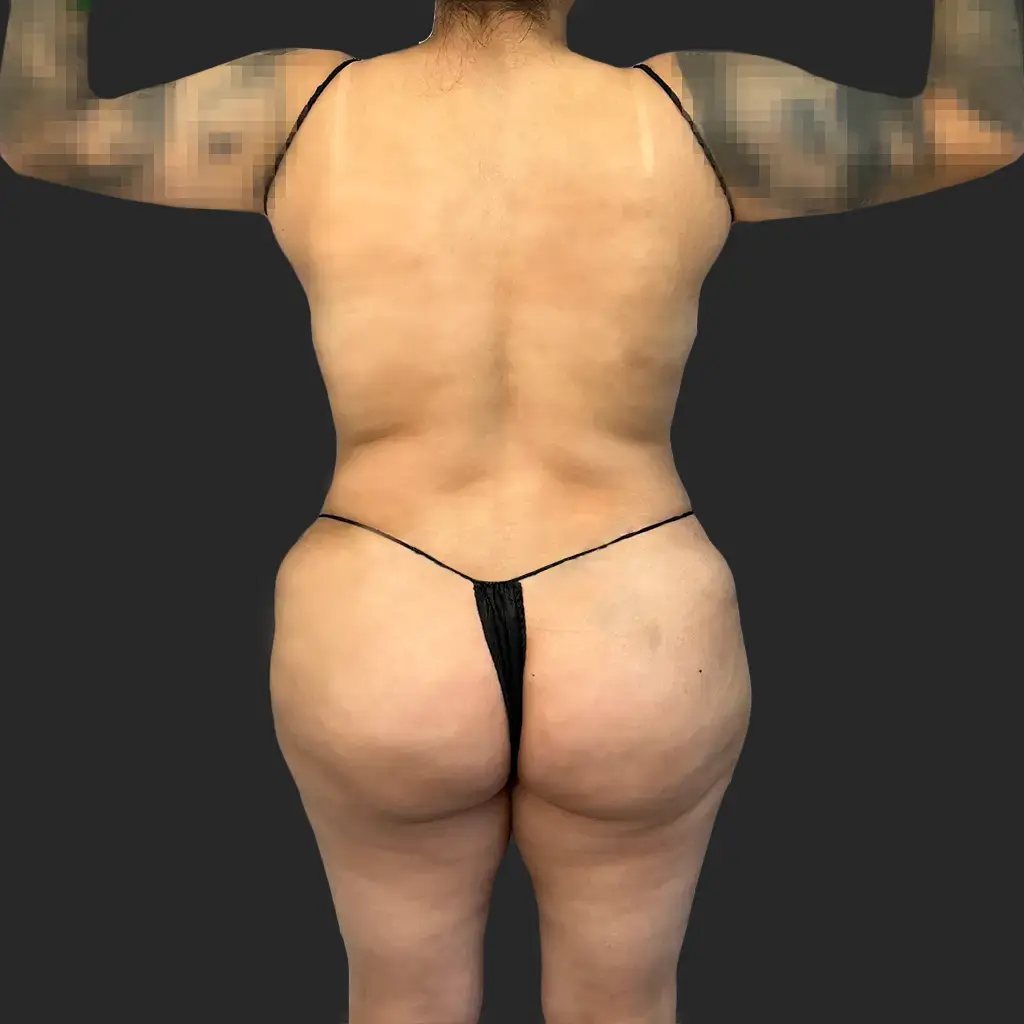 Before image