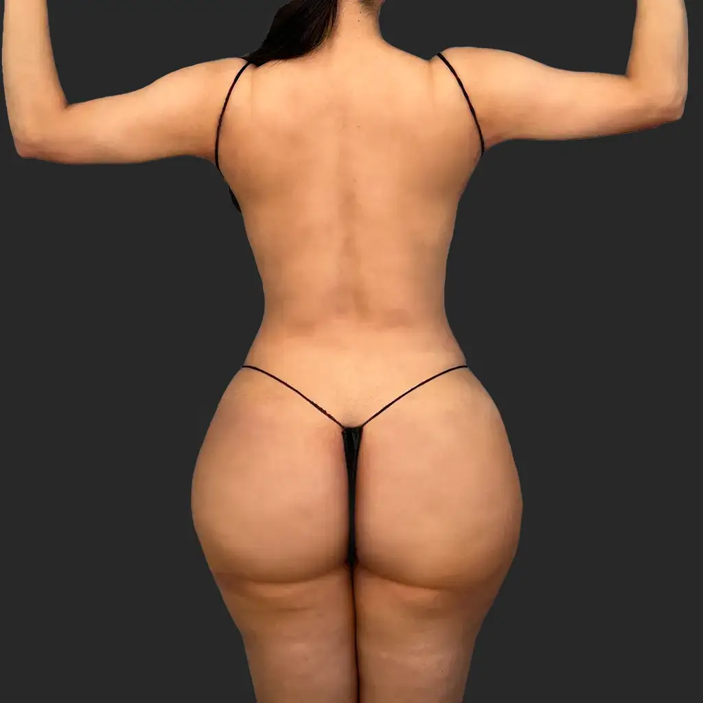 Before image