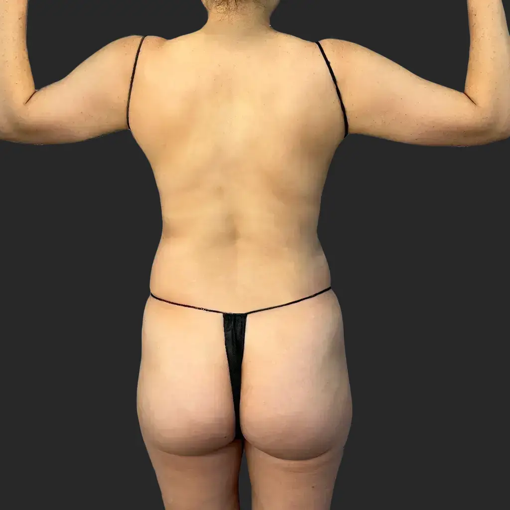 Before image