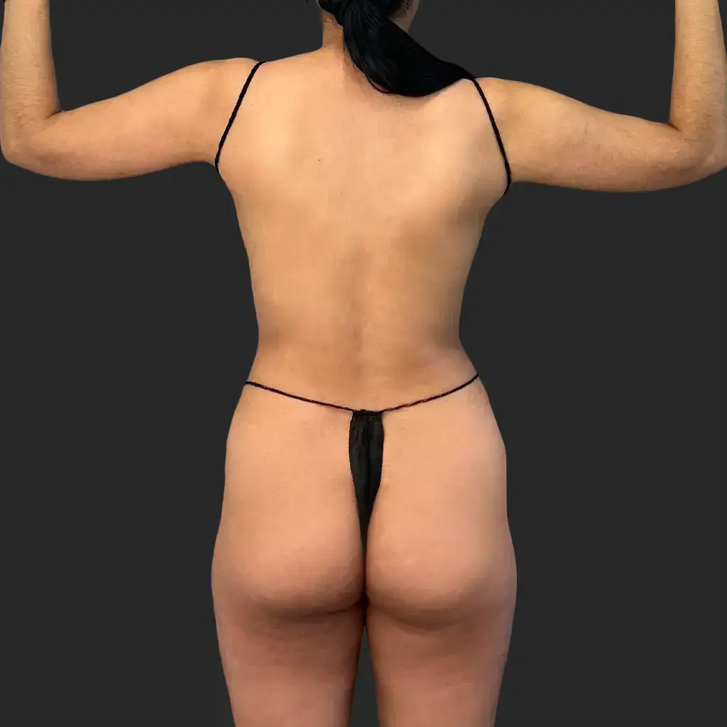 Before image