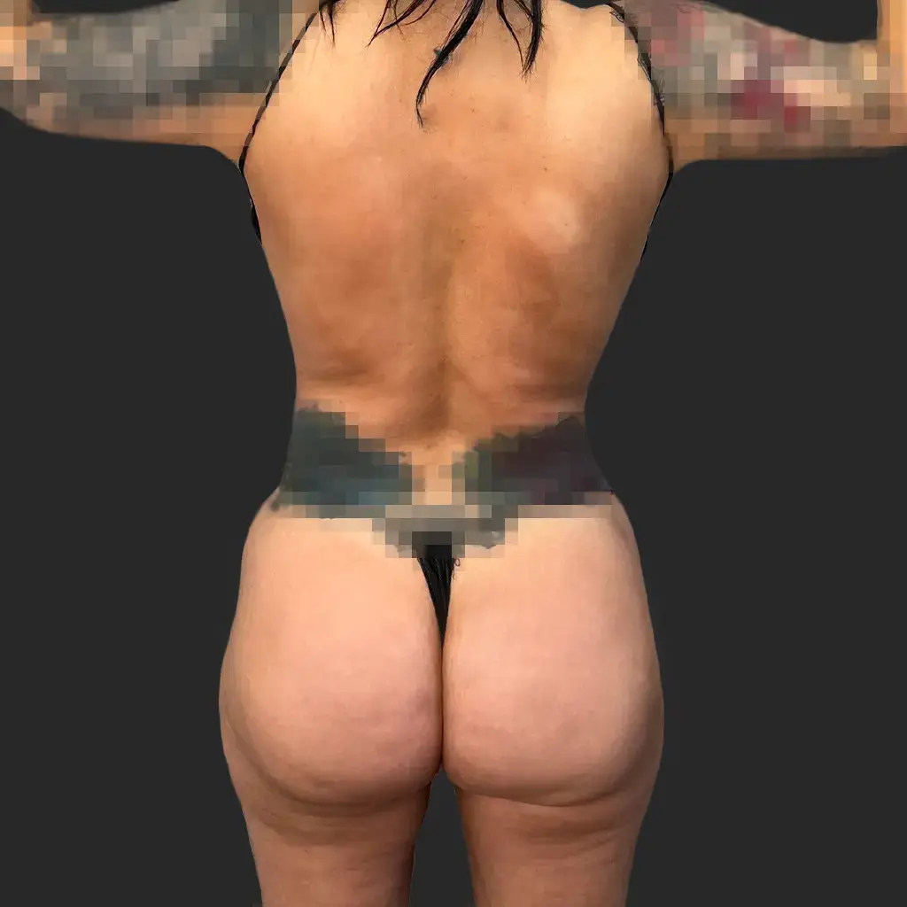 Before image