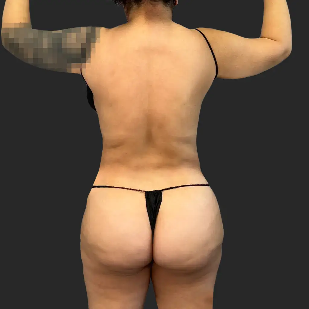 Before image