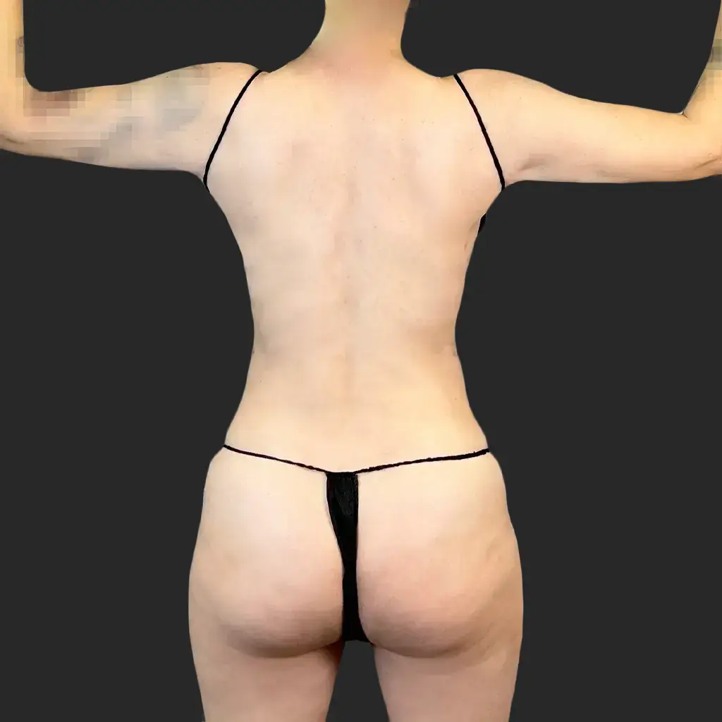 Before image