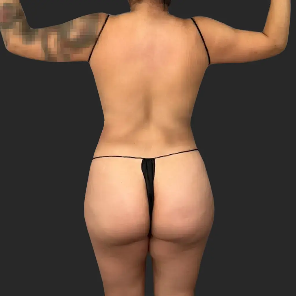 Before image