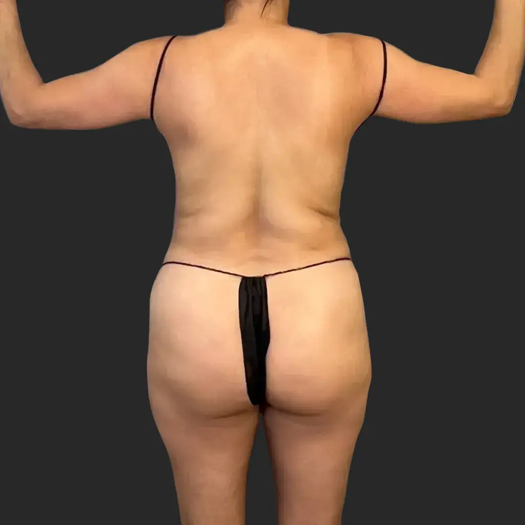Before image