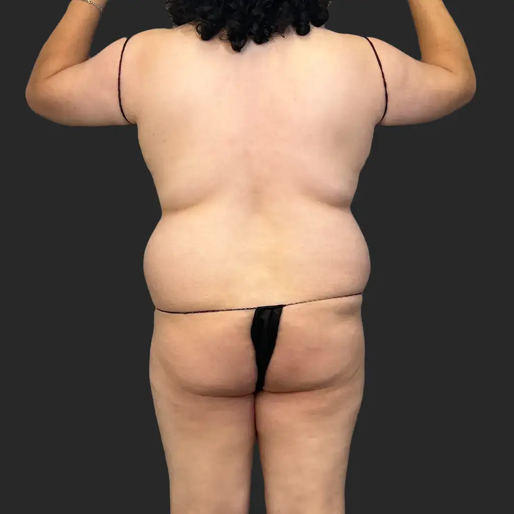 Before image
