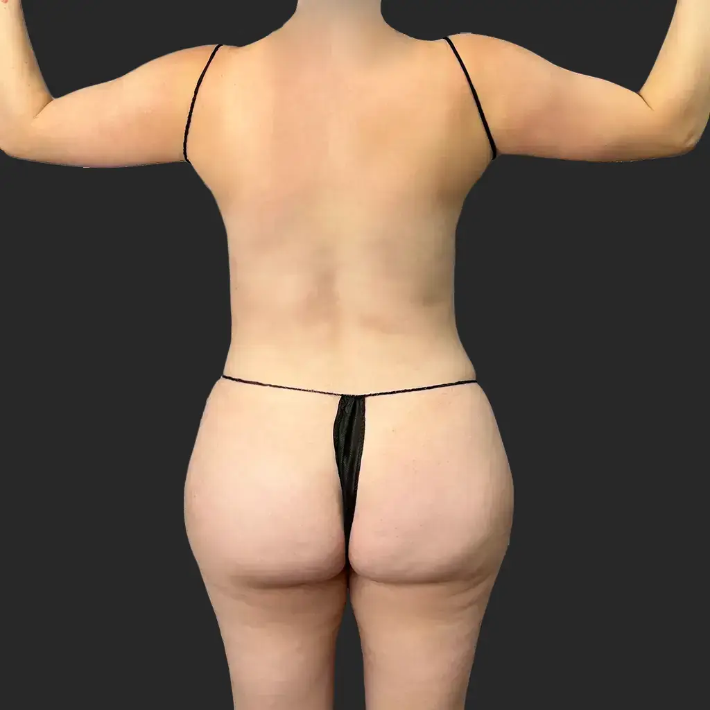 Before image
