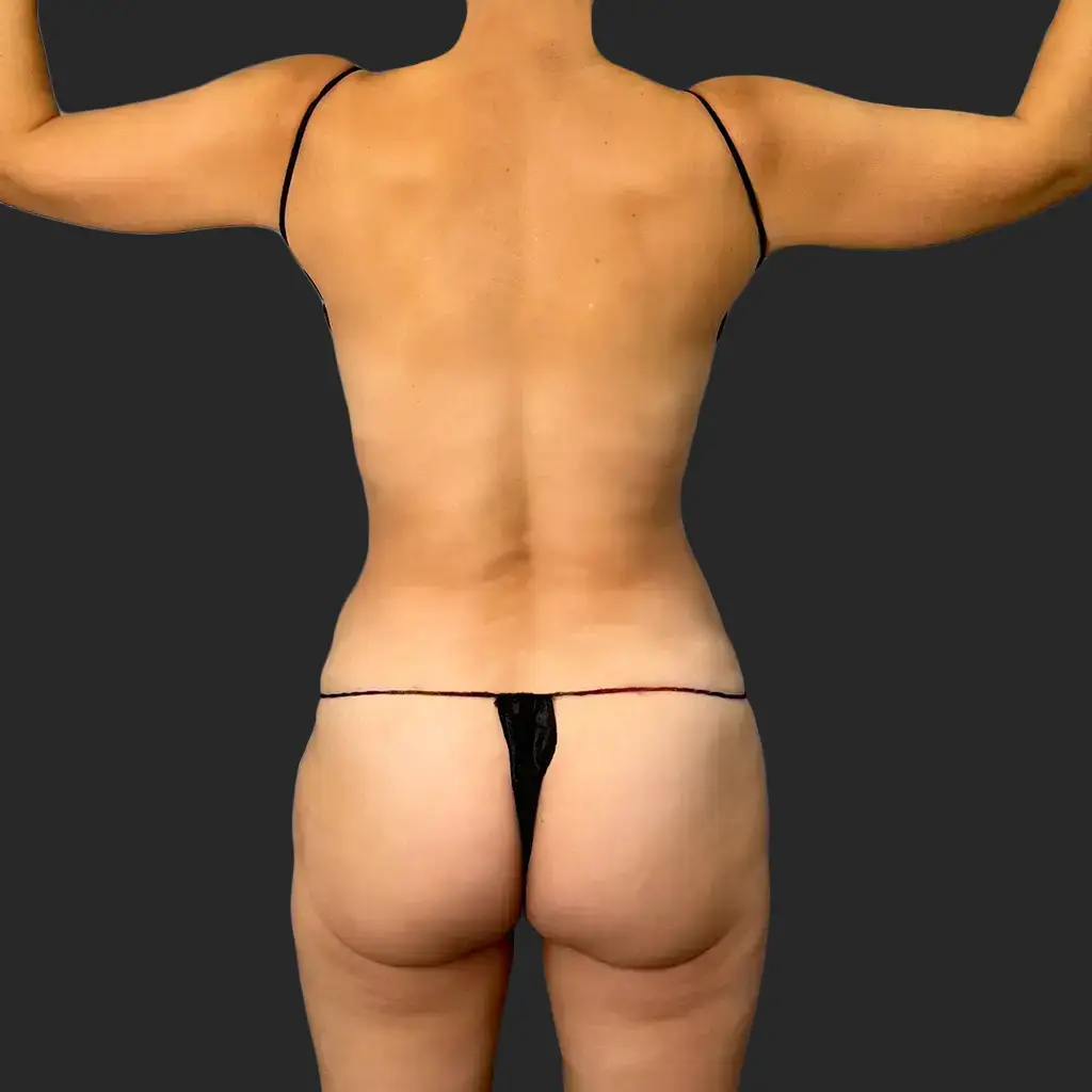 Before image