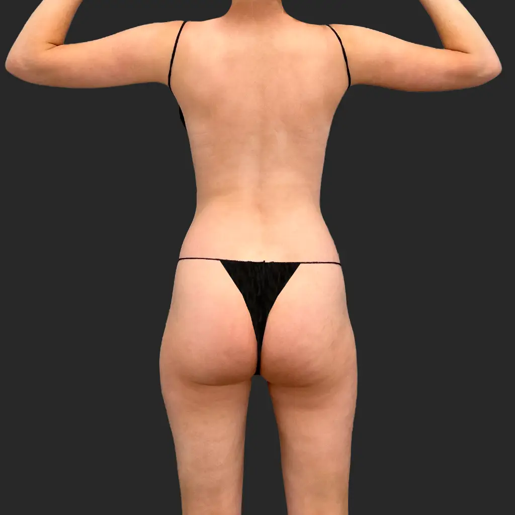 Before image