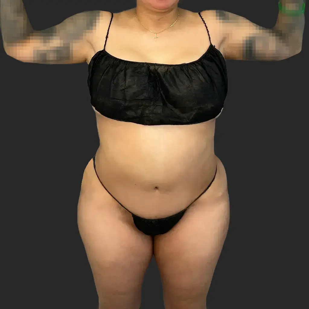 Additional before image