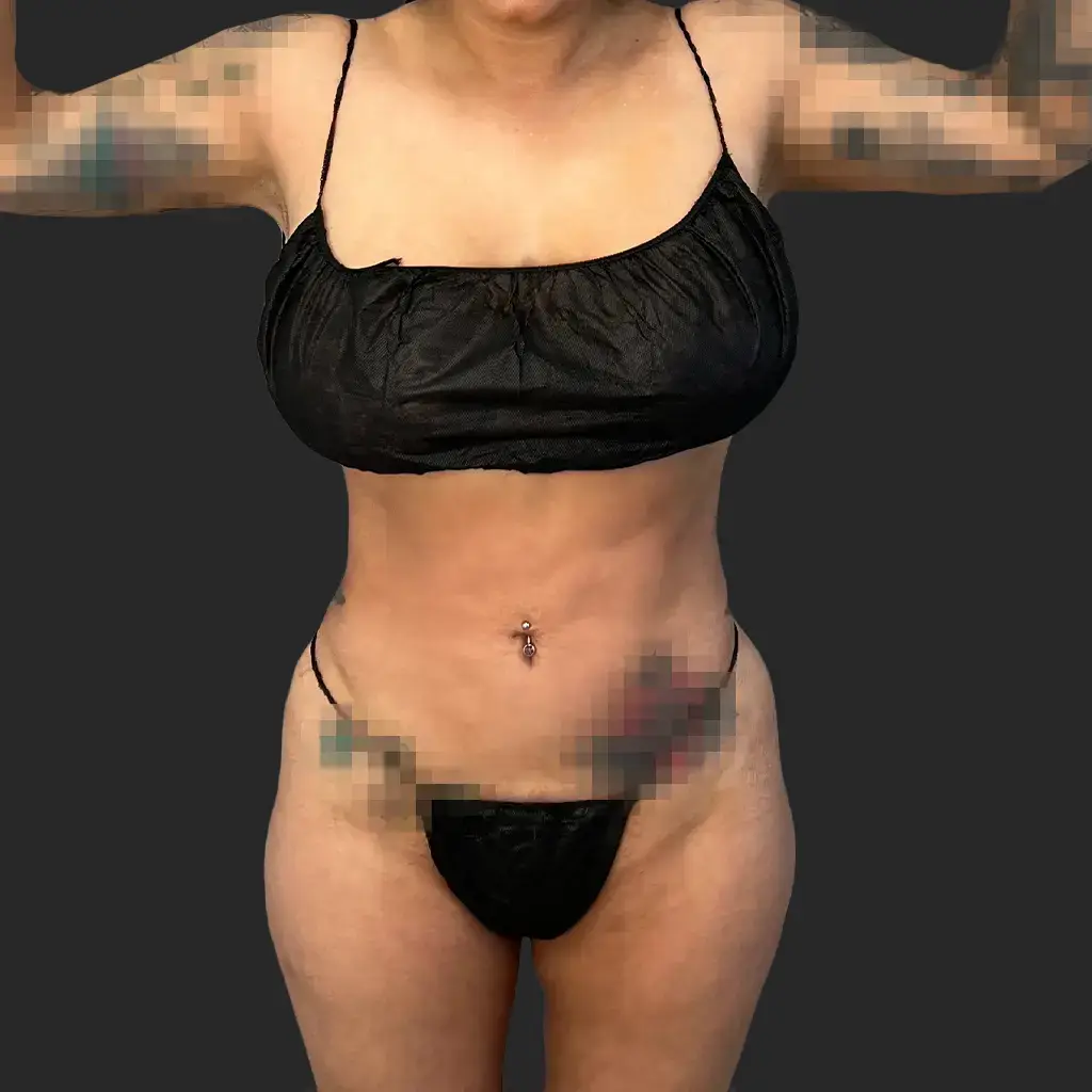 Additional before image