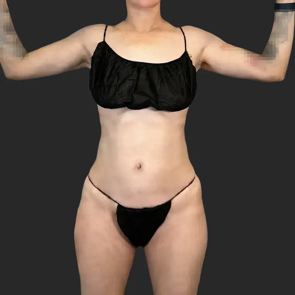 Additional before image