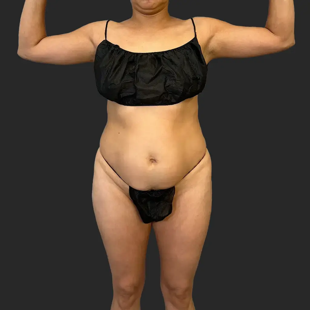 Additional before image