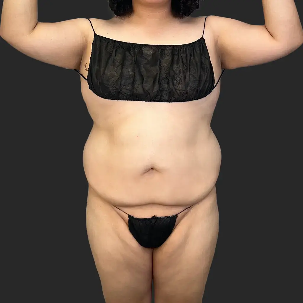 Additional before image