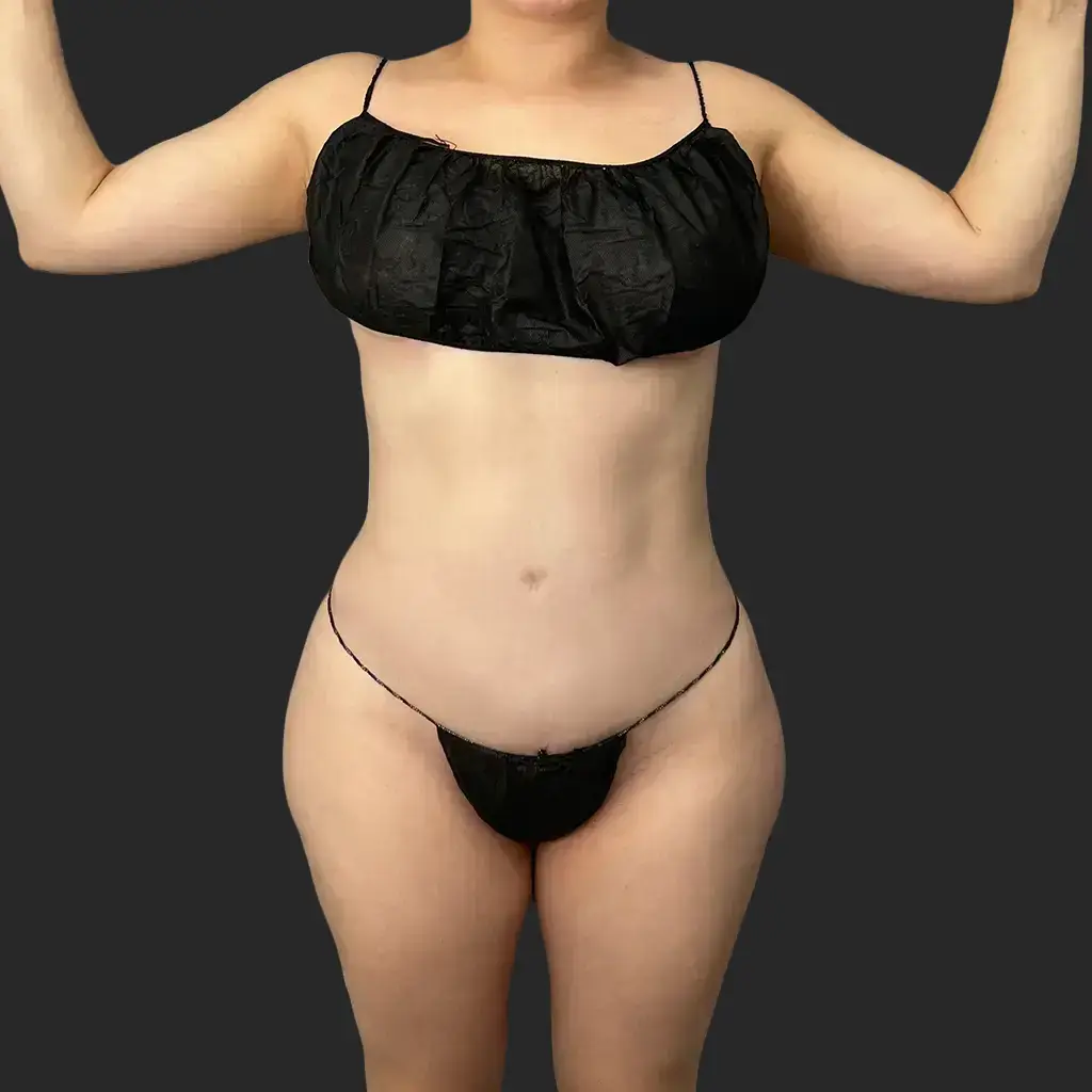 Additional before image