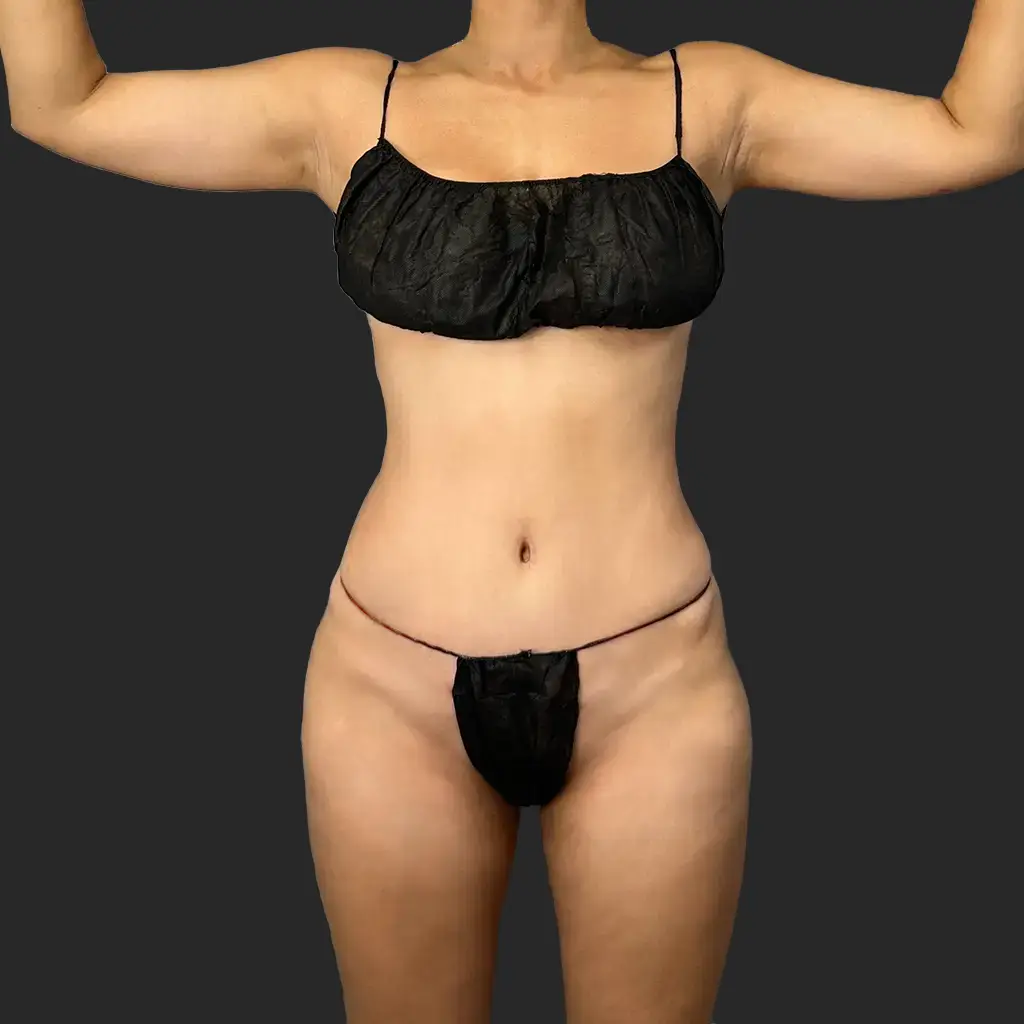 Additional before image