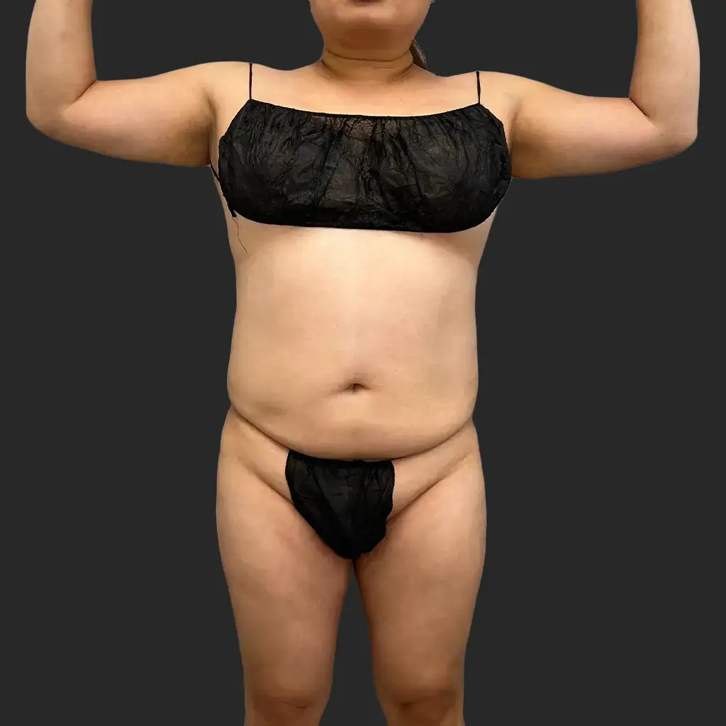 Additional before image