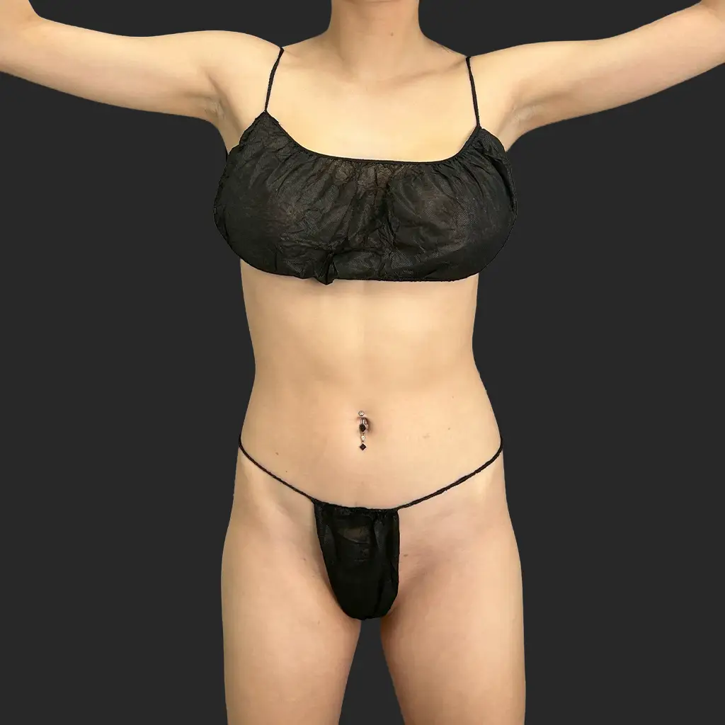 Additional before image