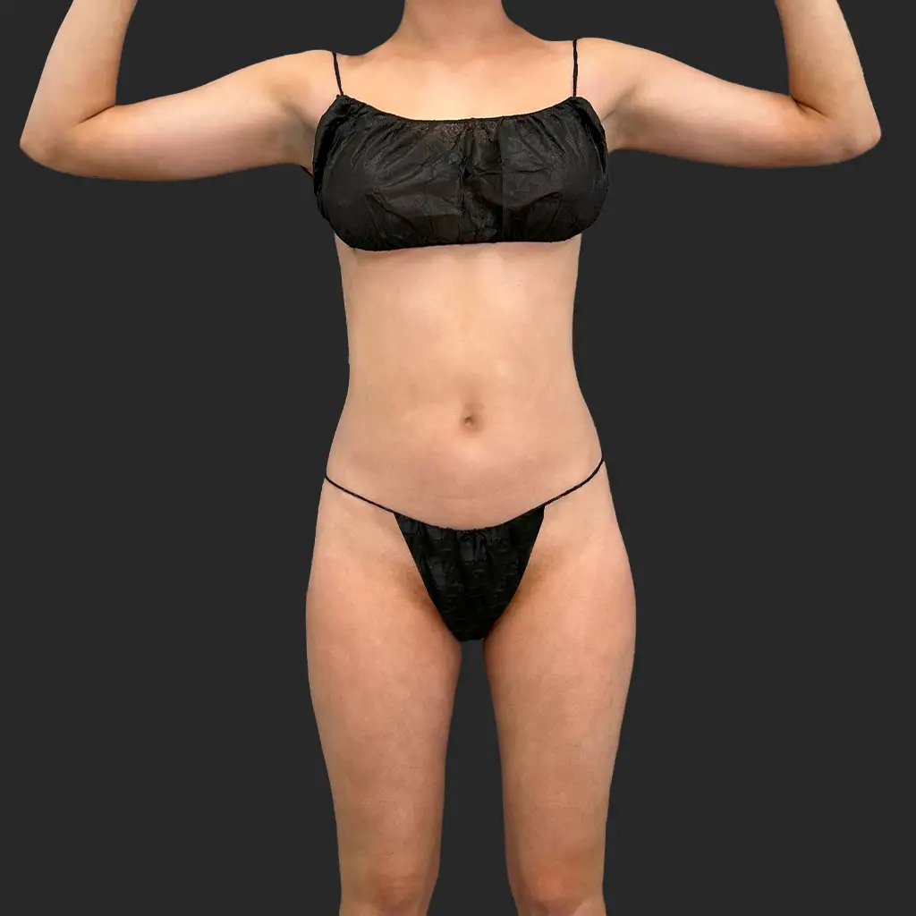 Additional before image